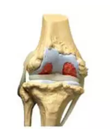 Flexi Bone review